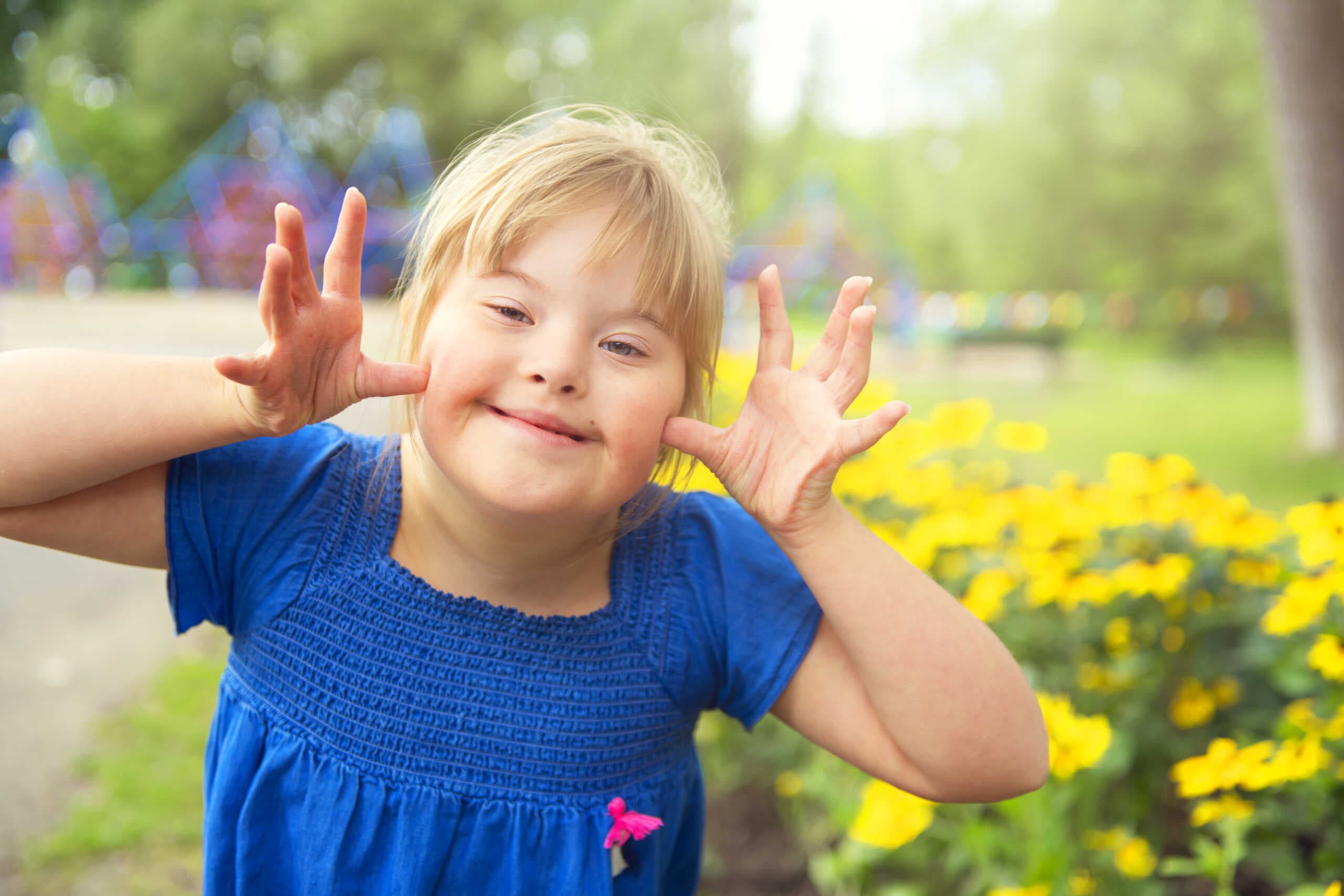 A smiling child with Down syndrome.